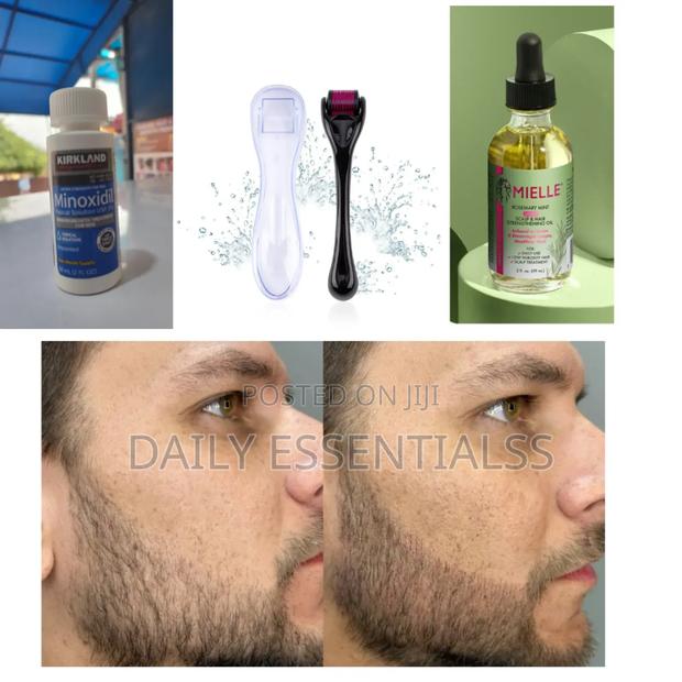 The Power Growth Kit – Kirkland, Mielle Roller Combo · Photo 2