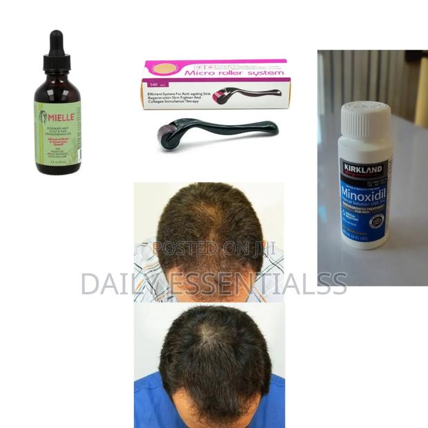 3-Step Hair Beard Growth – Mielle, Kirkland Roller · Photo 2
