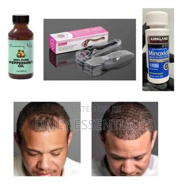 Kirkland, Peppermint Derma Roller Combo · Photo 2