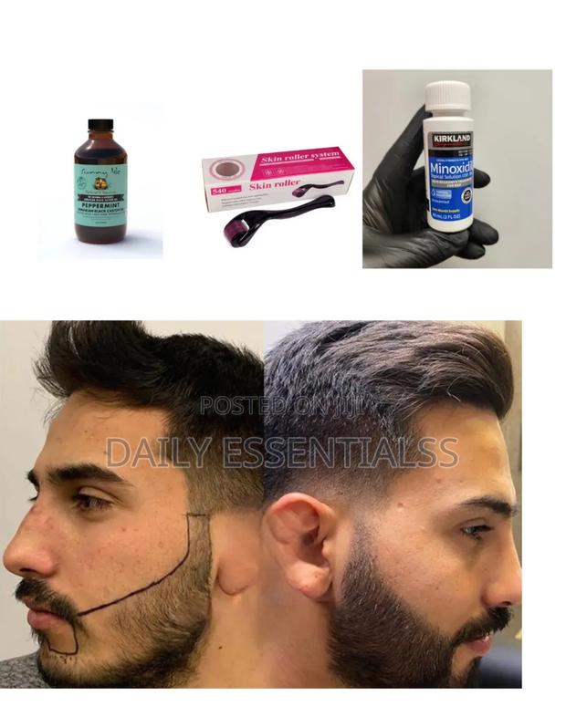 Kirkland Minoxidil, Derma Roller Peppermint Power Pack · Photo 2