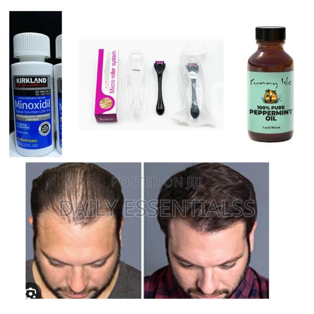 Kirkland, Peppermint Derma Roller – Growth Game Strong · Photo 2