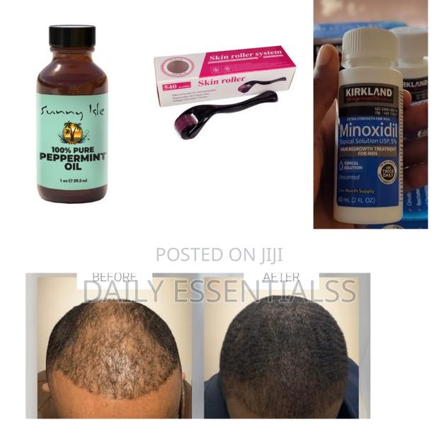 Kirkland, Peppermint Oil Derma Roller Growth Set · Photo 2