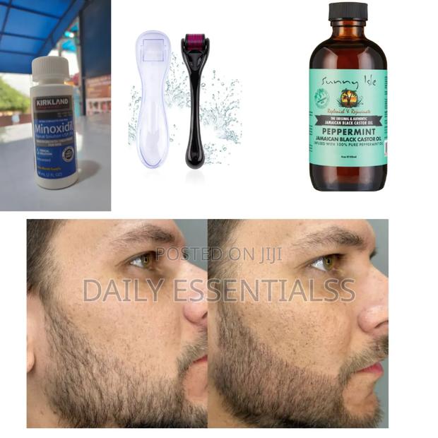 Derma Roller, Kirkland Peppermint Oil Hair Boost Trio · Photo 2