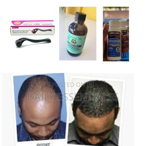 Kirkland Minoxidil,Derma Roller Peppermint Oil Combo Pack · Photo 2