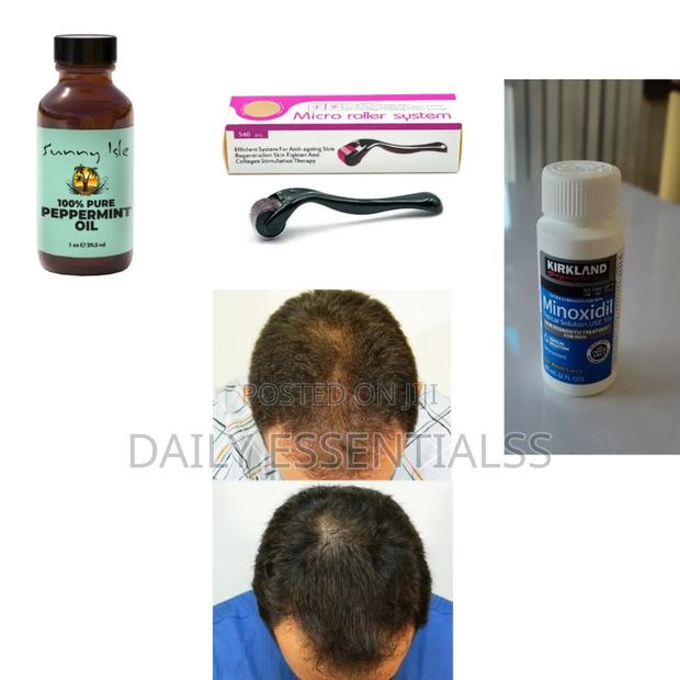Kirkland+ Derma Roller +Peppermint Oil Hair Beard Booster · Photo 2