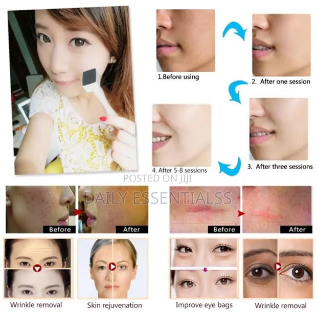 Micro-Pin Perfection – Derma Stamp Skincare Tool · Photo 4