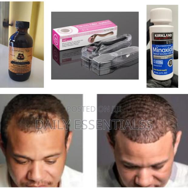 Thicker Hair Kit – Naturally Scientifically Backed · Photo 2
