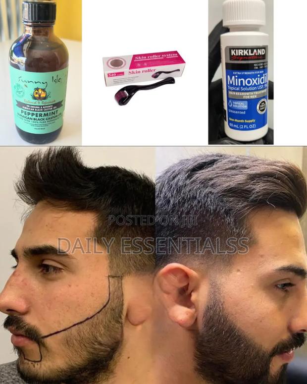 Kirkland Minoxidil + Peppermint + Derma Roller Kit · Photo 2