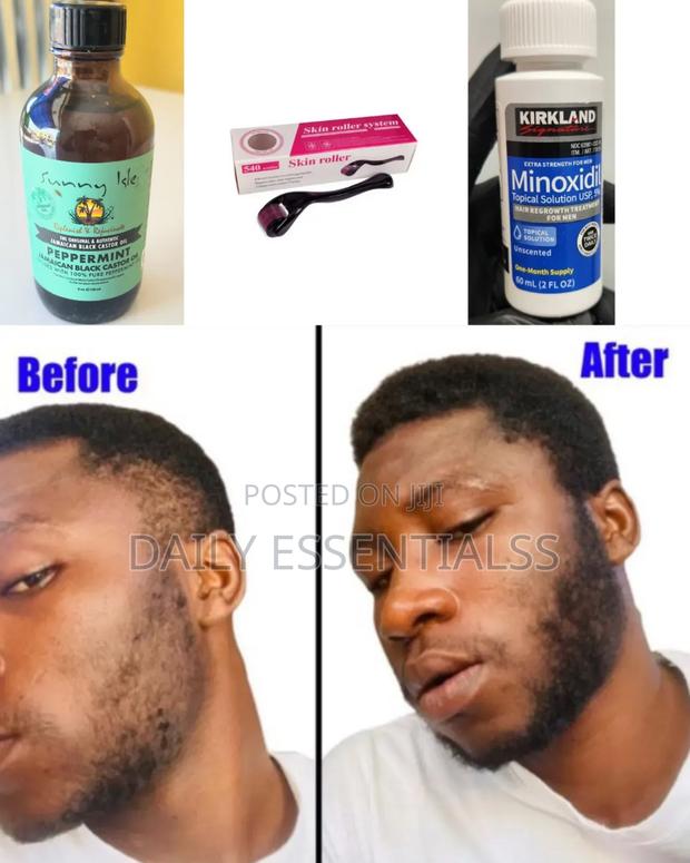 Kirkland + Peppermint Oil + Derma Roller Beard Hair Builder · Photo 2