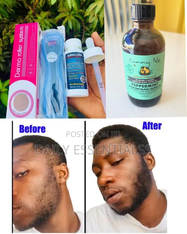 Kirkland, Mielle Roller Set for Thicker Hair Beard · Photo 2
