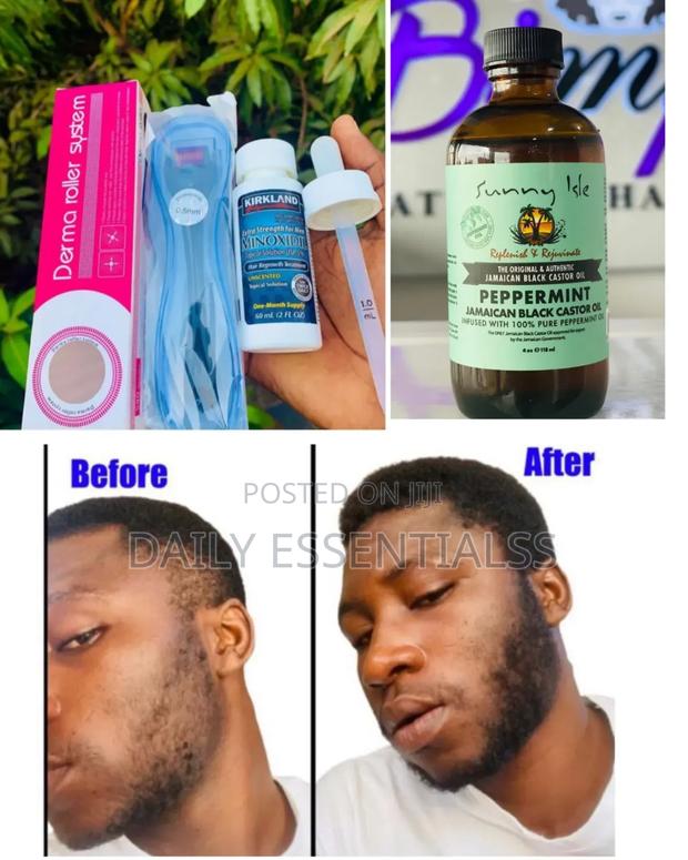 Kirkland, Derma Roller Peppermint – The Growth Team · Photo 2