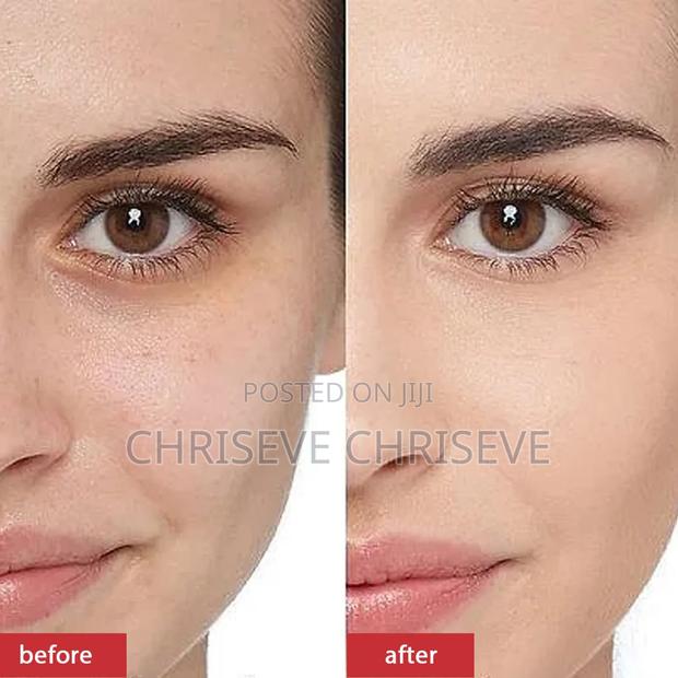 Kojic Skin Whitening Lotion photo 2