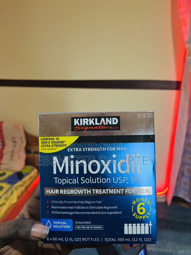 Say Goodbye to Hair Loss – Minoxidil to the Rescue! · Photo 4