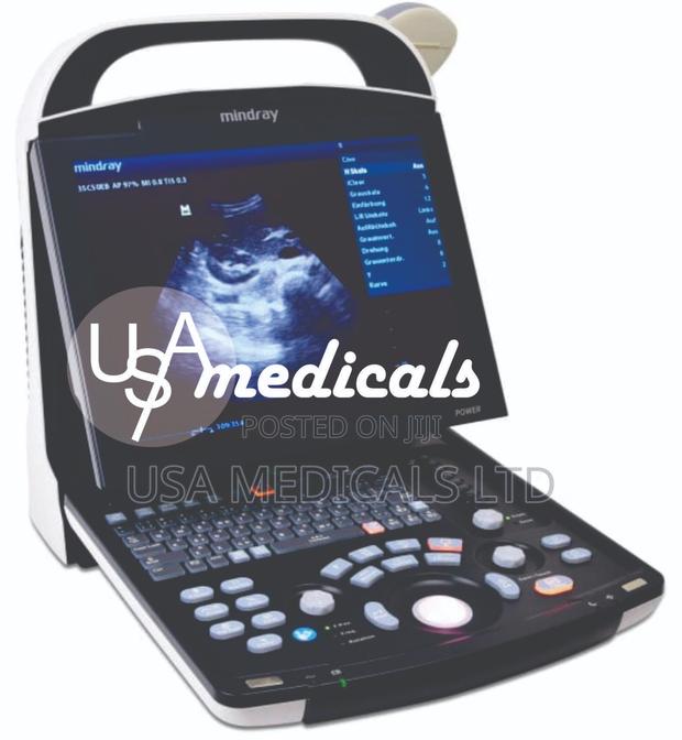Mindray Dp 10 Ultrasound Scan Machine With Convex Probes · Photo 2