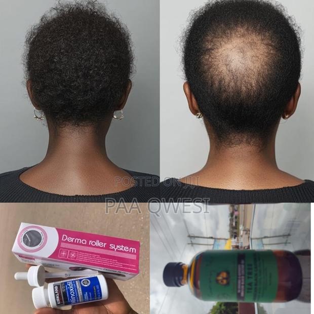 3 in 1 Hair Kit: Kirkland, Castor Oil Roller · Photo 2