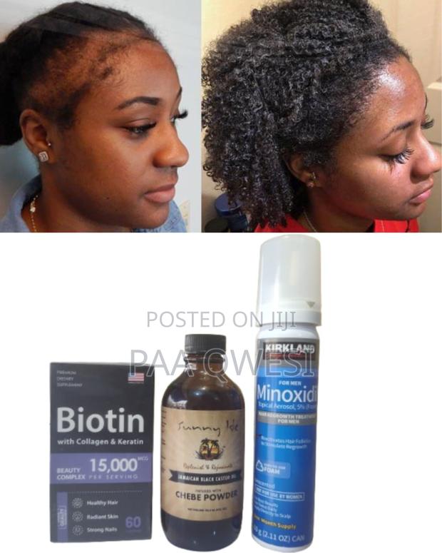 Triple Boost Hair Growth Set- Biotin + Foam + Chebe · Photo 2