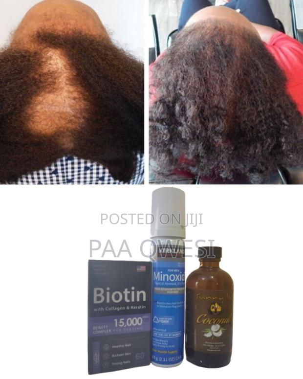 Full Hair Growth Trio - Biotin + Coconut + Foam · Photo 2