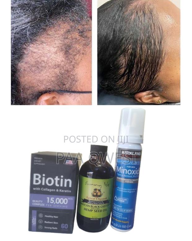 Biotin + Hemp Seed + Kirkland Foam · Photo 2