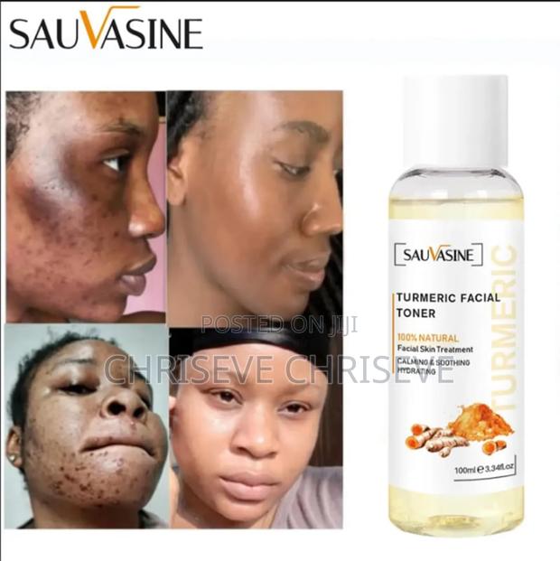 Tumeric Face and Neck Toner photo 6