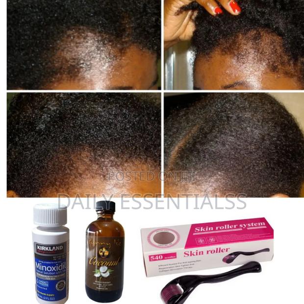 Kirkland , Coconut Oil + Derma Roller for Hair Regrowth · Photo 2