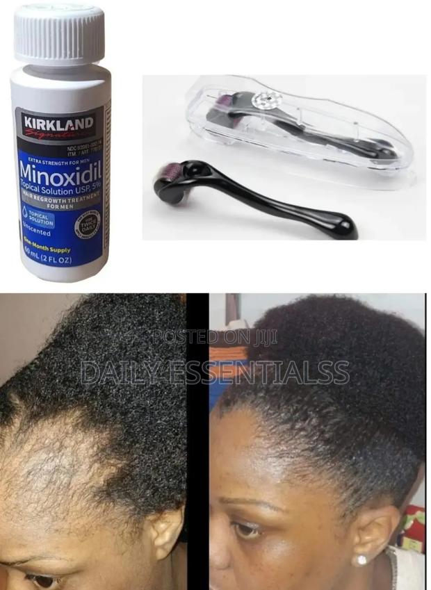 Kirkland Derma Roller Kit · Photo 2