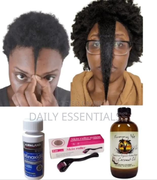 Minoxidil, Roller Sunny Isle Coconut Oil Combo · Photo 2