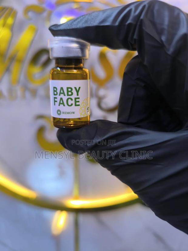 Babyface Fat Dissolving Injection for Stubborn Areas Face (One Vial) · Photo 4