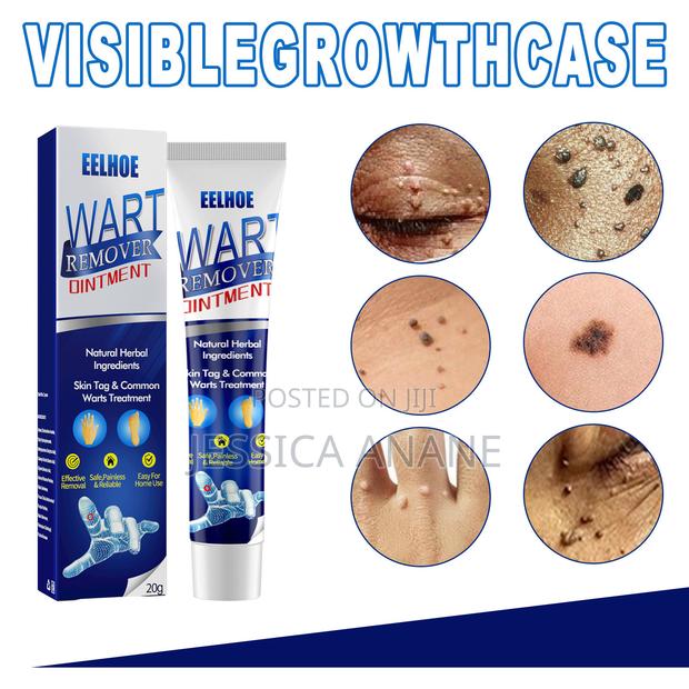 Eelhoe Skin Tags and Warts Remover Ointment · Photo 1