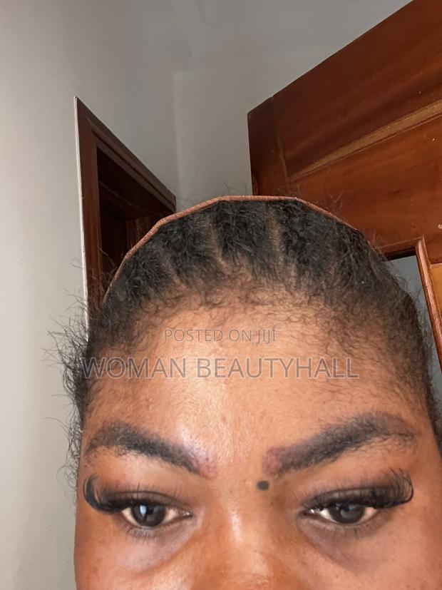 Laser Brows Removal · Photo 4