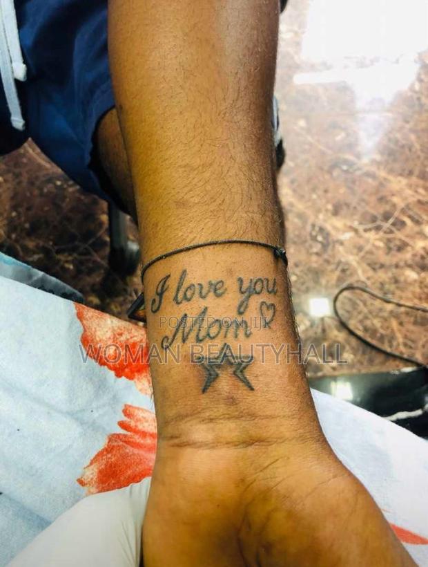 Tattoo Removal · Photo 3