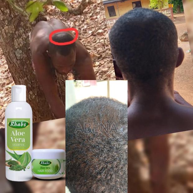 Bald Head Solution · Photo 2