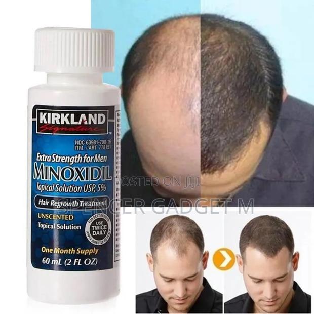 Kirkland Minoxidil 5% Hair Growth Treatment 60ml photo 2