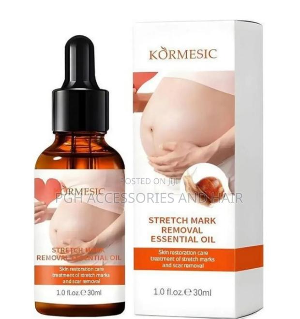 Stretch Marks Oil