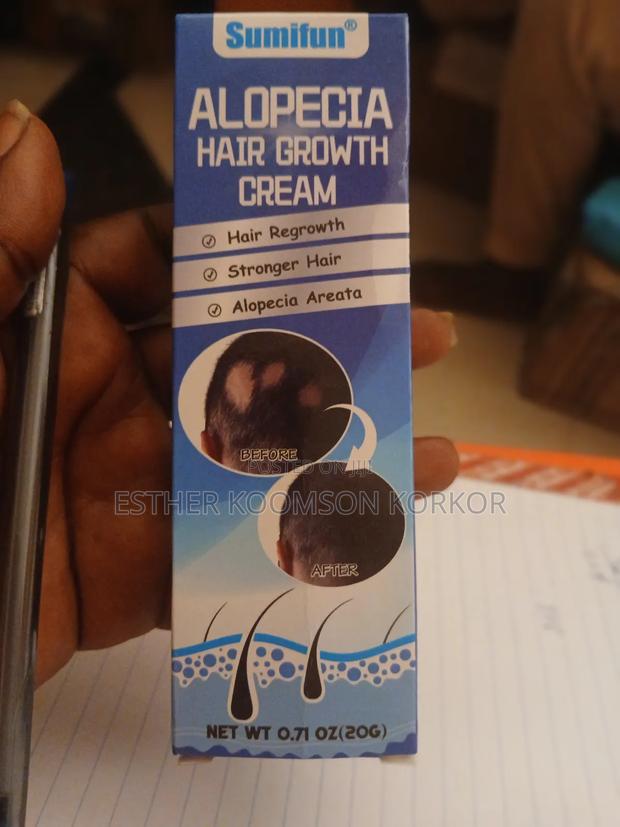 Alopecia Hair Growth Cream · Photo 1