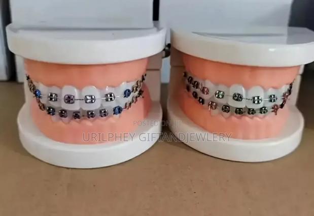 Fashion Braces photo 2