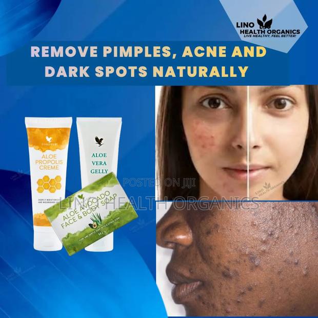 Pimples, Acne and Dark Spots Removal Pak · Photo 2