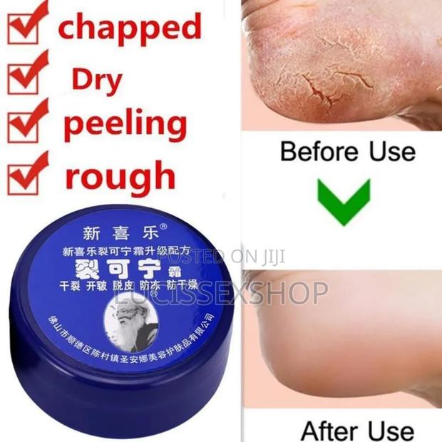 Anti Crack Foot Cream · Photo 4