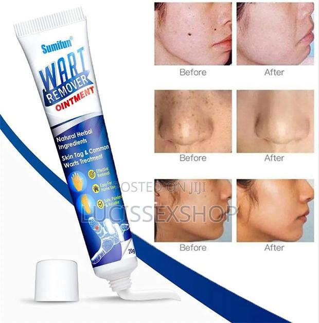 Genital Wart Removal Cream · Photo 2