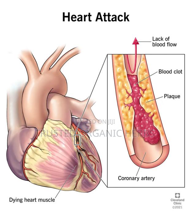 High Blood Pressure/ Bad Cholesterol/ High Blood Sugar Solution photo 3