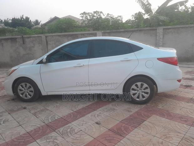 Hyundai Accent 2015 White photo 2