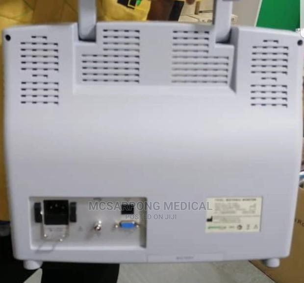 Cardiotocograph (CTG) Machine · Photo 2